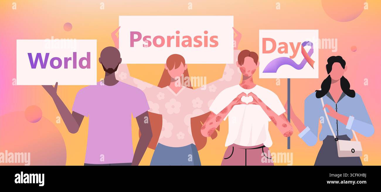 Un groupe de femmes et d'hommes en vêtements décontractés tient une pancarte dans les mains avec l'inscription Journée mondiale du psoriasis. Concept médical. Vecteur non généré par IA Banque D'Images