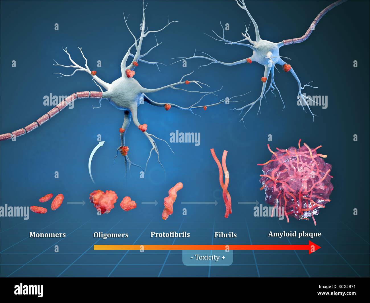 Diagramme montrant les différentes étapes menant à la formation de plaques amyloïdes dans la maladie d'alzheimer. Illustration numérique, rendu 3D. Banque D'Images