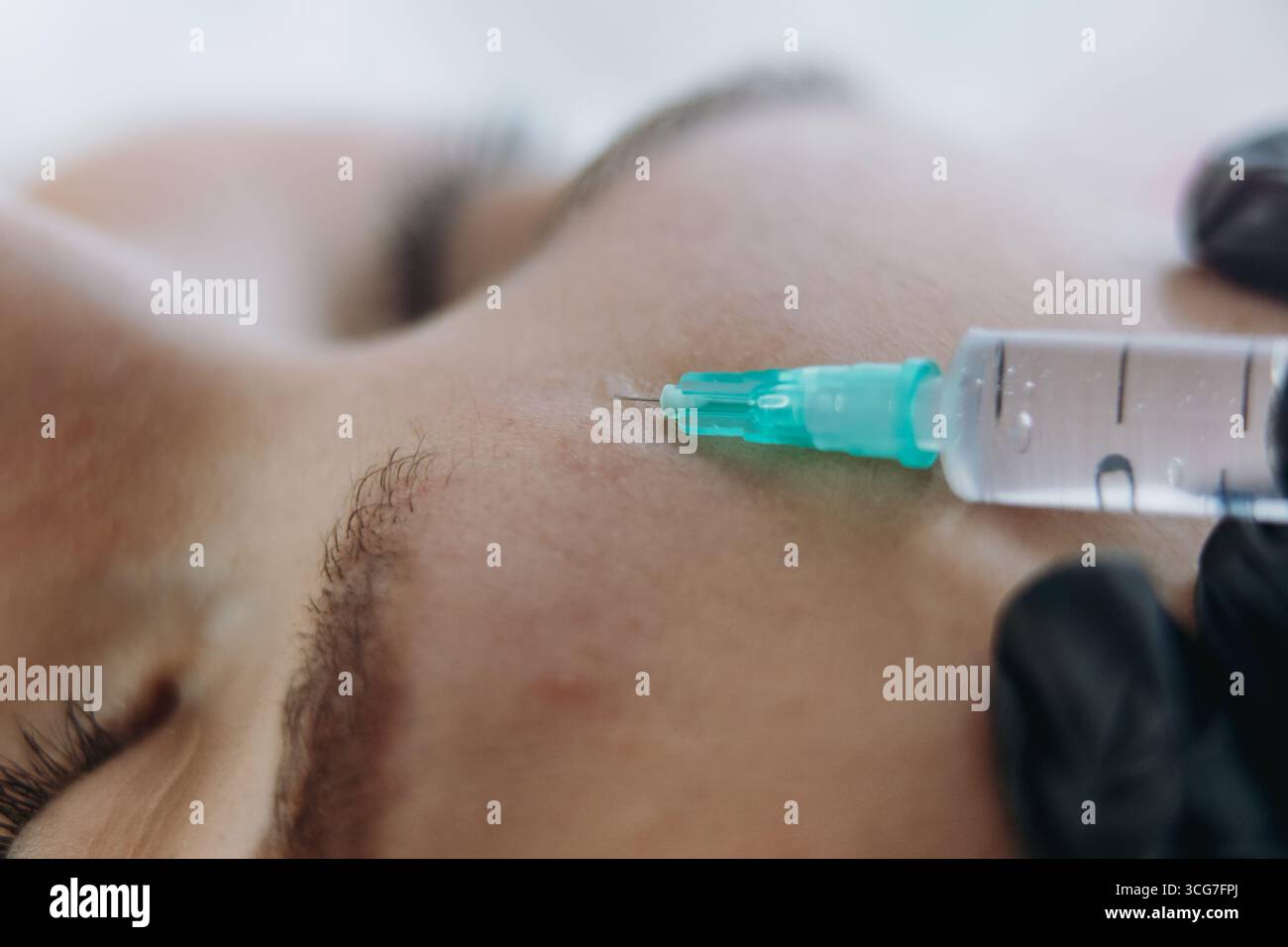 gros plan des mains professionnelles faisant une injection de rajeunissement dans la ligne sournoise de la femme Banque D'Images