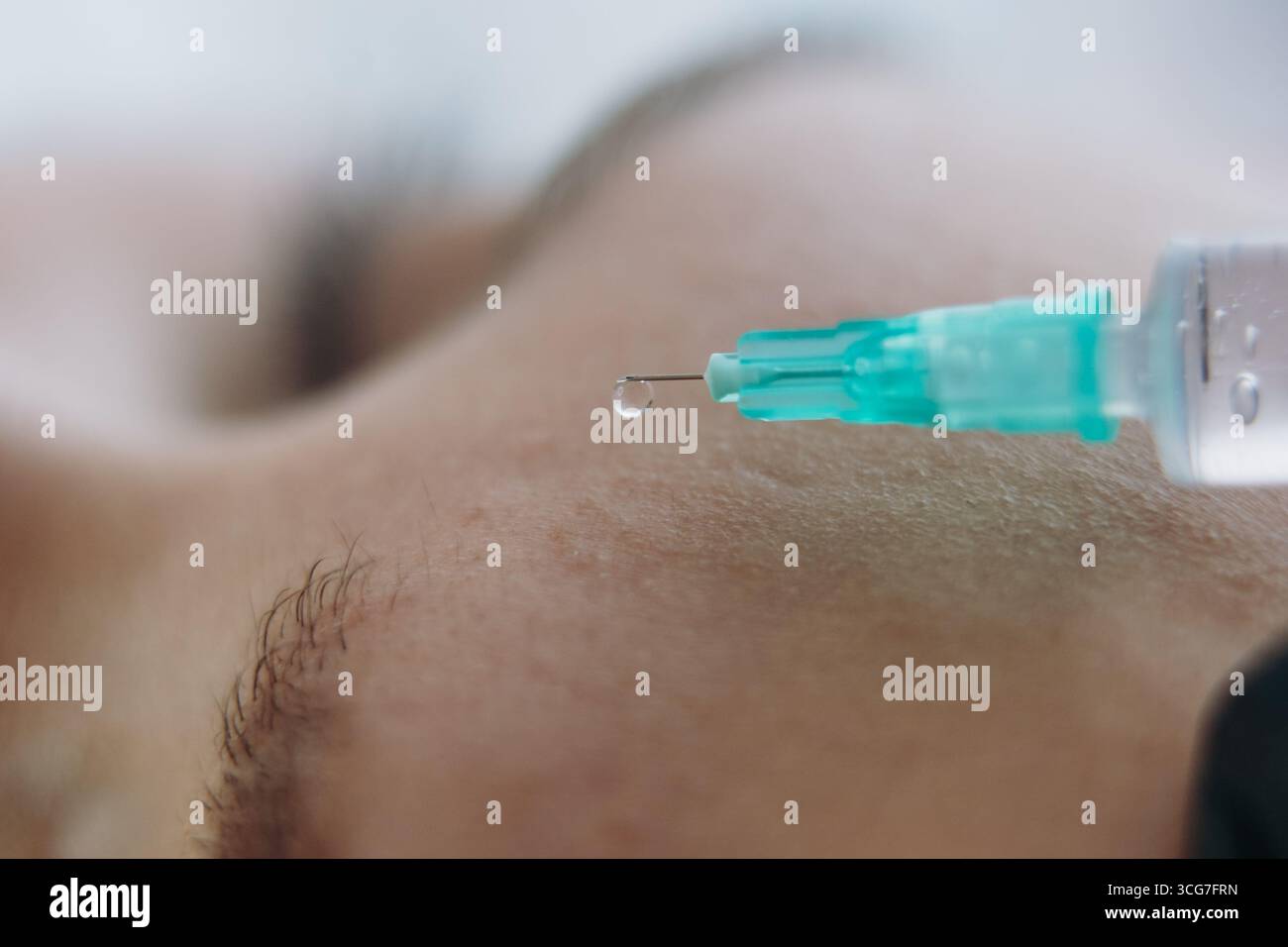 gros plan des mains professionnelles faisant une injection de rajeunissement dans la ligne sournoise de la femme Banque D'Images