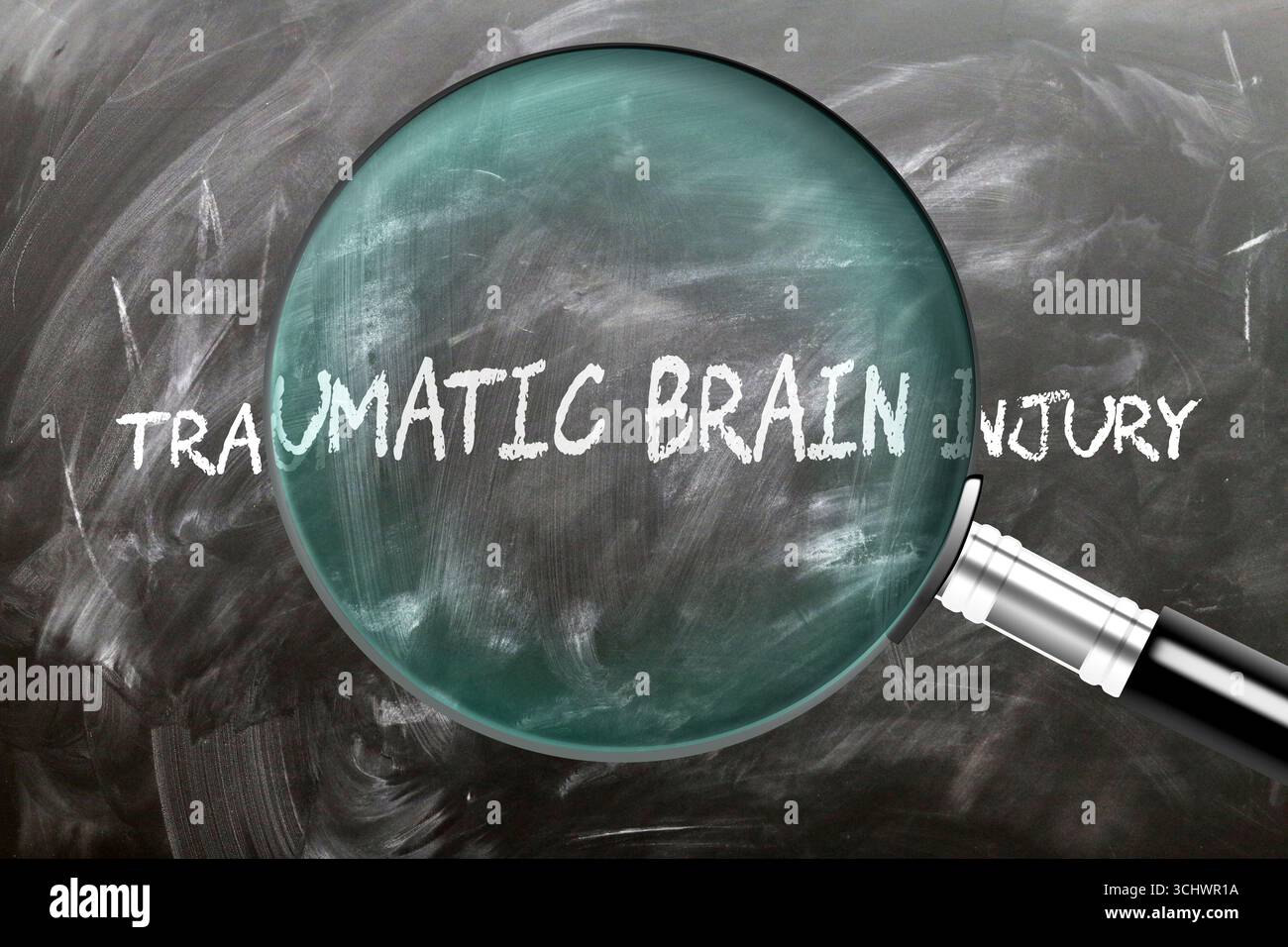 Traumatisme crânien - apprendre, étudier et inspecter. Examiner de plus près les traumatismes crâniens. Banque D'Images