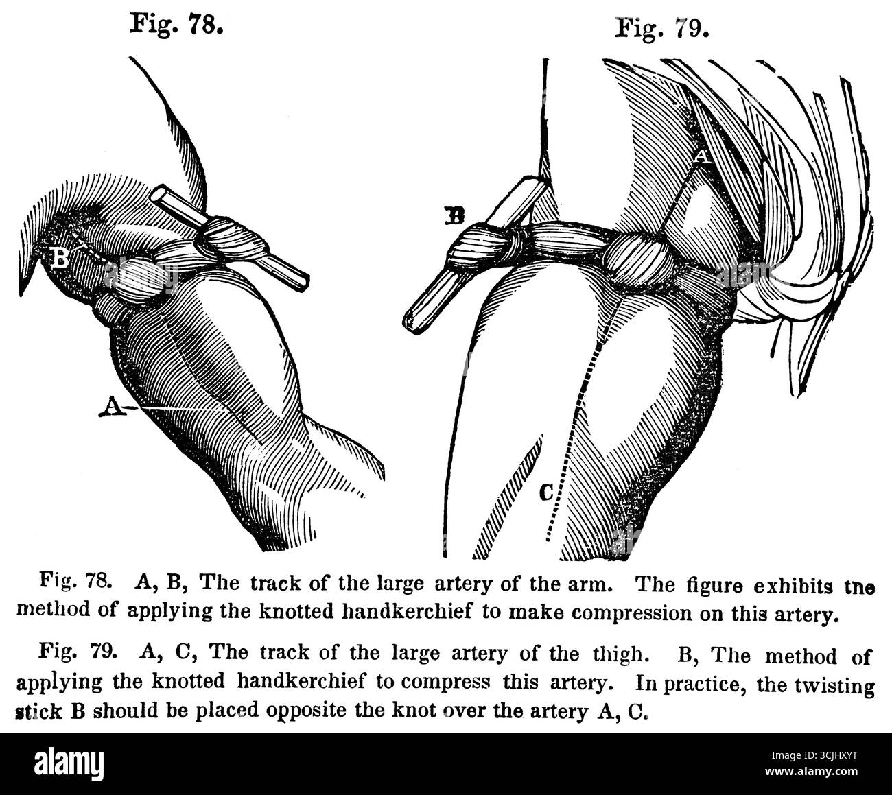 Anatomie, organes circulatoires, trace de la grande artère du bras et de la cuisse, illustration historique 1858 Banque D'Images