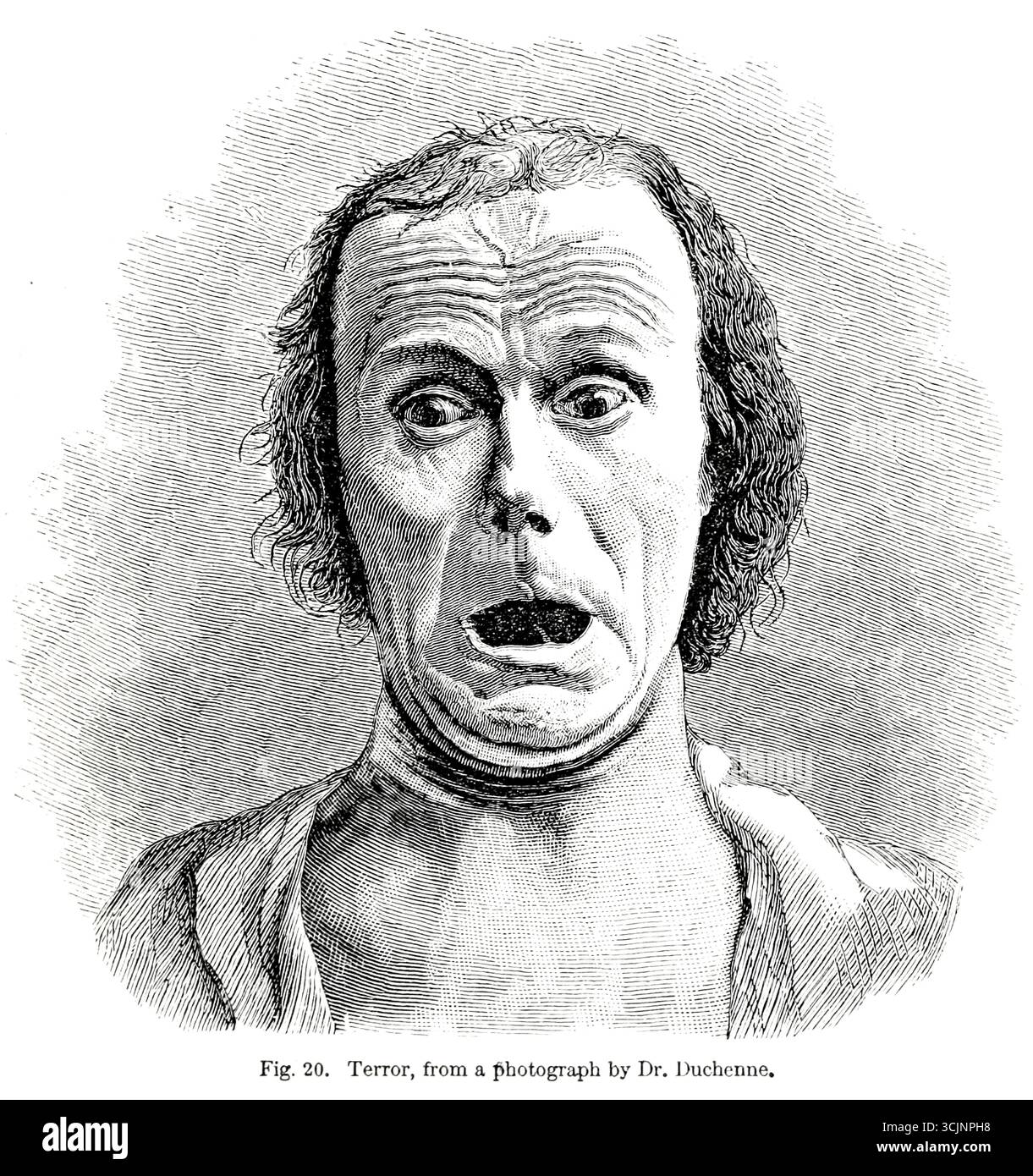 Terreur, d'après une photographie de Dr Duchenne tirée du livre ' L'expression des émotions chez l'homme et les animaux ' de Darwin, Charles, 1809-1882 date de publication 1873 Banque D'Images