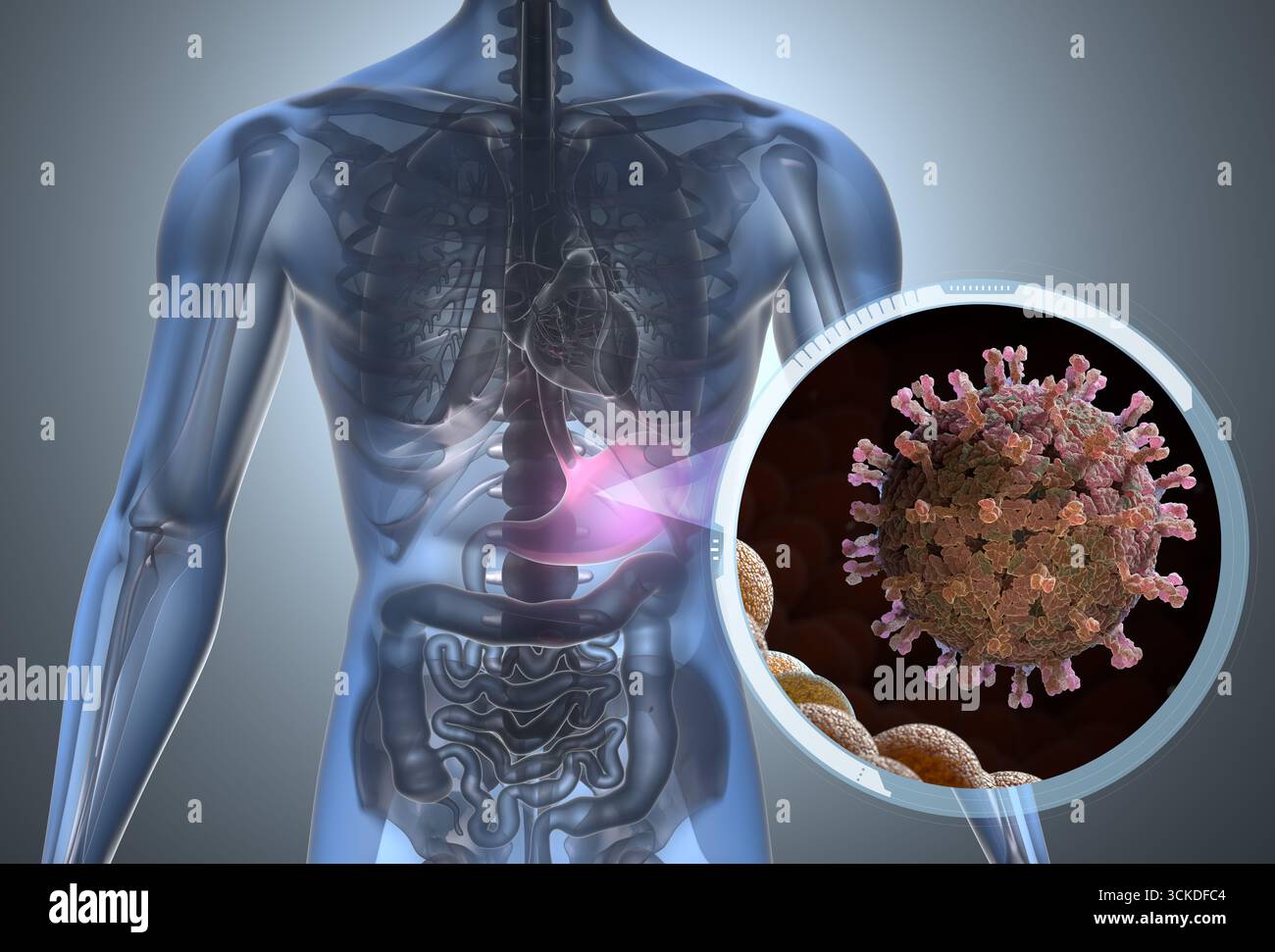 Bactéries rotavirus dans l'appareil digestif. Illustration 3D. Banque D'Images