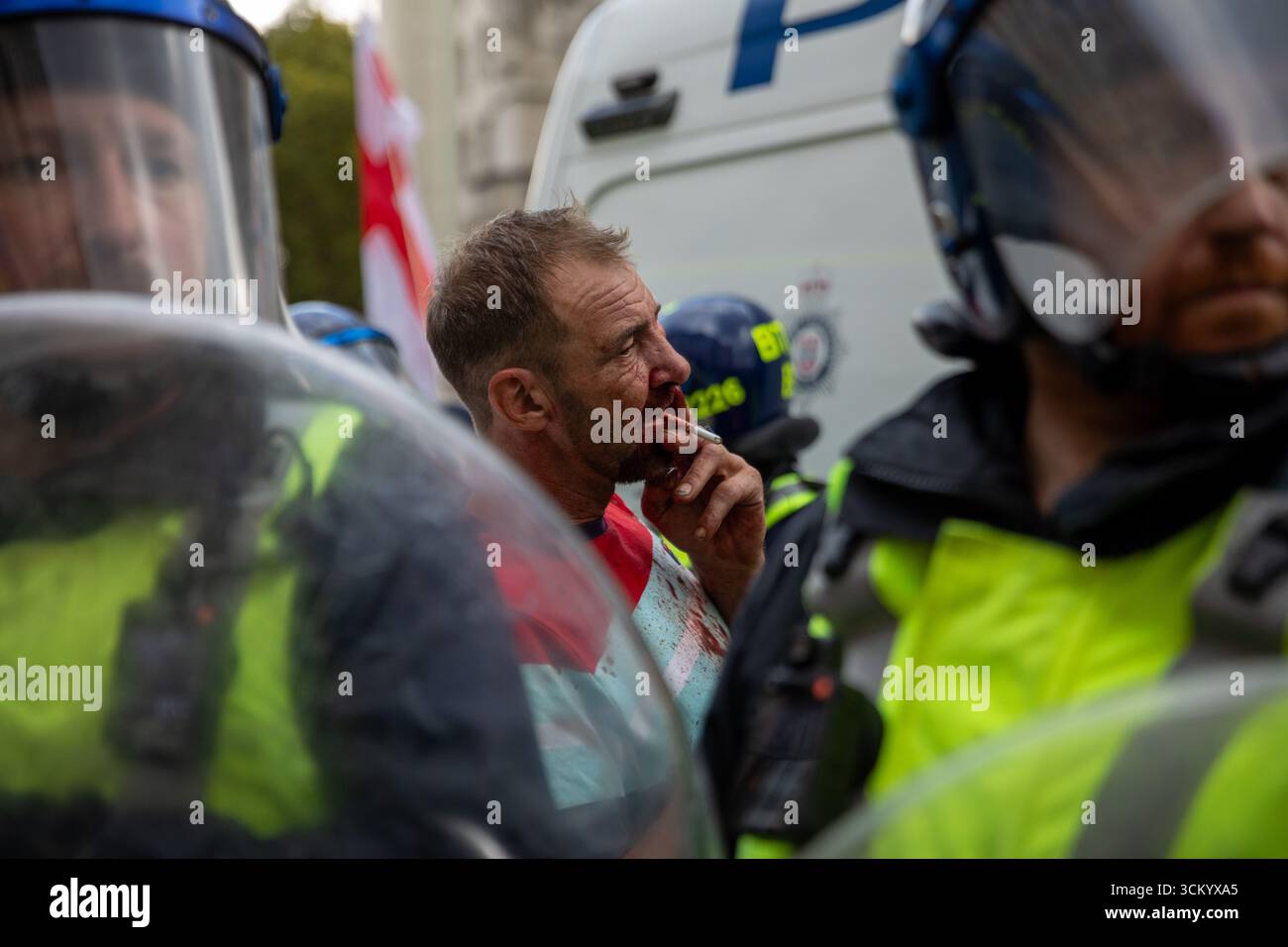 Londres, Royaume-Uni. 13 septembre 2025. Un homme blessé fume une cigarette lors d'une manifestation. Le rassemblement de mars Unite the Kingdom London organisé le 13 septembre 2025 a attiré des milliers de participants. Cet événement a été organisé par le militant politique Stephen Yaxley-Lennon, également connu sous le nom de Tommy Robinson, qui a précédemment dirigé des manifestations similaires axées sur les questions d'immigration et d'intégration sociale. Le calendrier du rassemblement coïncide avec les débats nationaux en cours sur les contrôles aux frontières, la cohésion communautaire et la montée de l'islam radical. Crédit : SOPA images Limited/Alamy Live News Banque D'Images