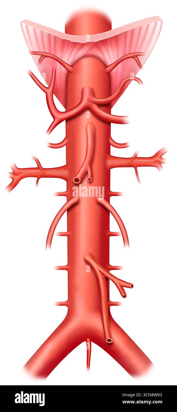 Illustration de l'aorte abdominale, elle commence dans l'abdomen, au-delà du diaphragme et s'étend jusqu'au bassin. Cette artère est responsable du transport du sang riche en oxygène et en nutriments vers l'abdomen, le bassin et les membres inférieurs, le tronc cœliaque, les artères mésentériques et les artères rénales. Banque D'Images