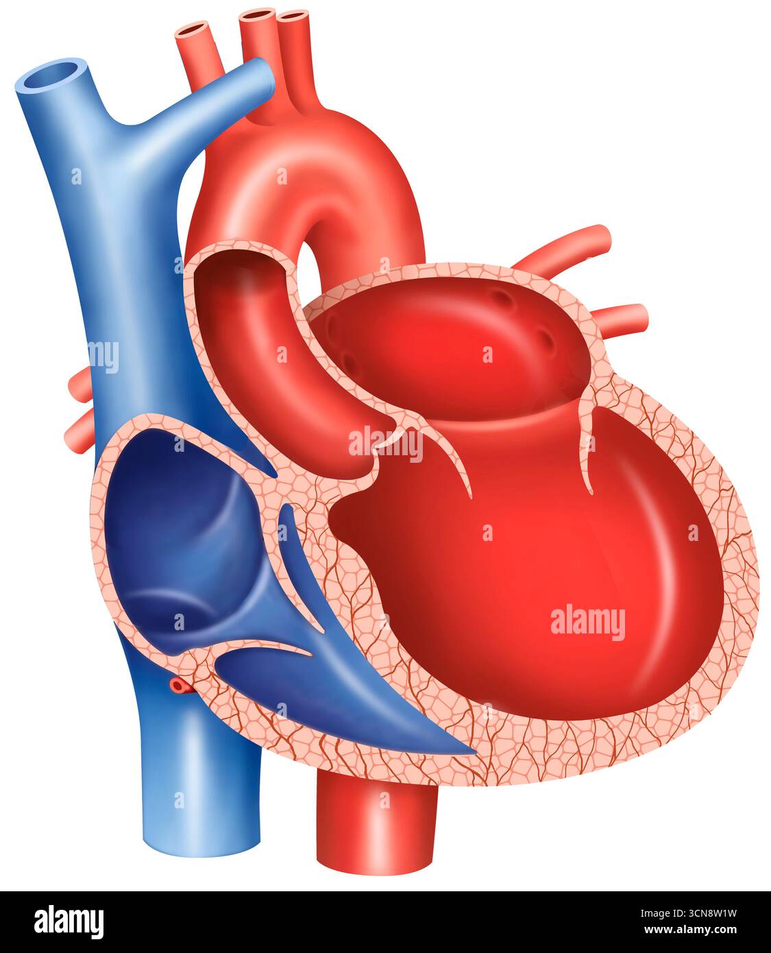 Illustration montrant une cardiomyopathie dilatée. Il s'agit d'une condition cardiaque dans laquelle les cavités cardiaques, en particulier le ventricule gauche, deviennent agrandies et affaiblies, affectant la capacité du cœur à pomper le sang efficacement. Cela peut entraîner des symptômes tels que fatigue, essoufflement et œdème. Banque D'Images