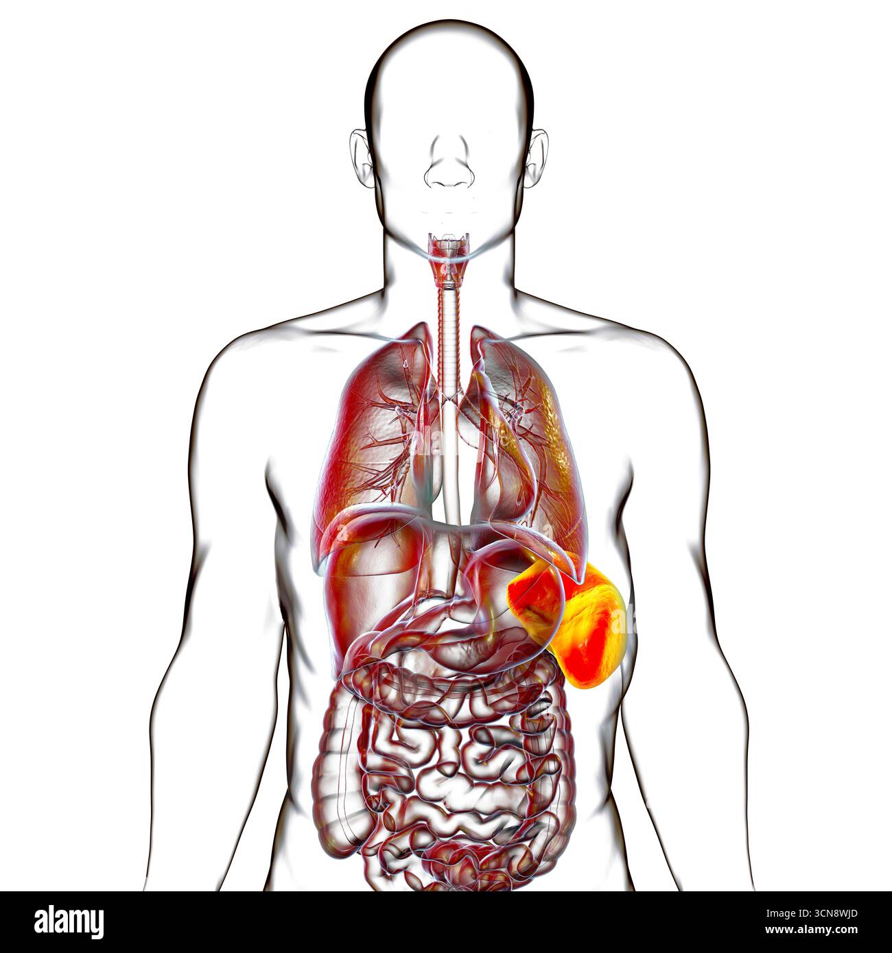 Splénomégalie. Illustration montrant une rate agrandie. Cela se produit dans les infections, la cirrhose du foie, la leucémie, le lymphome, le paludisme et les maladies auto-immunes. Banque D'Images