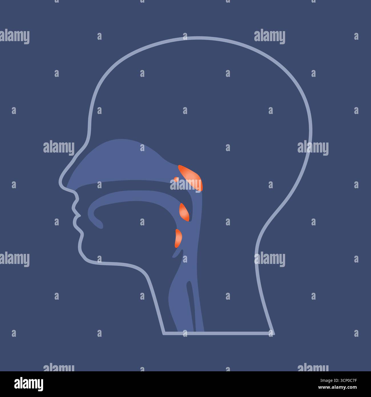 Amygdales et adénoïdes, illustration en coupe transversale de la tête humaine. Banque D'Images