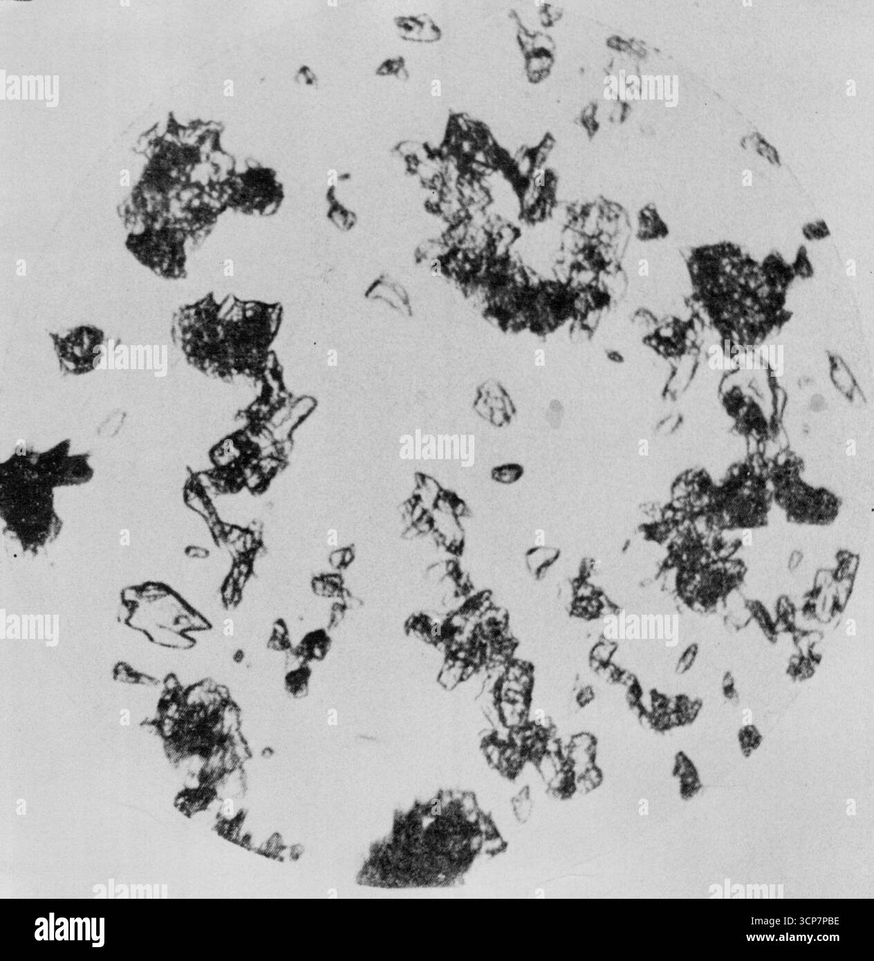 Prélèvements au microscope. Celle de gauche est négative. Cela à droite montre une réaction positive. Le concentré indique la benzédrine et le chlorure de platine. Les observateurs entraînés identifient facilement les cristaux. 28 janvier 1950. Banque D'Images
