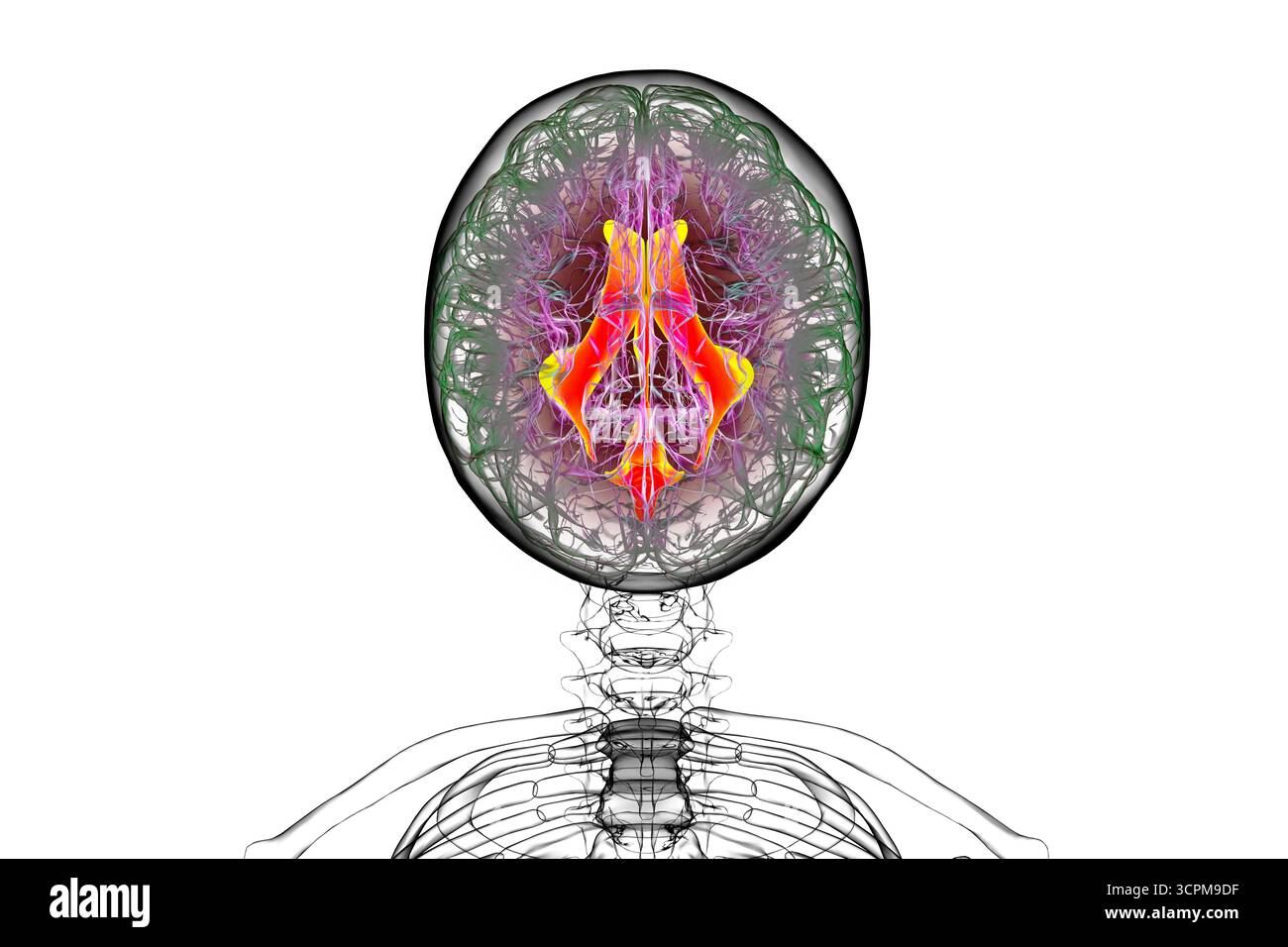 Système ventriculaire du cerveau, illustration. Les ventricules sont des cavités du cerveau qui sont remplies de liquide céphalo-rachidien (LCR). Banque D'Images