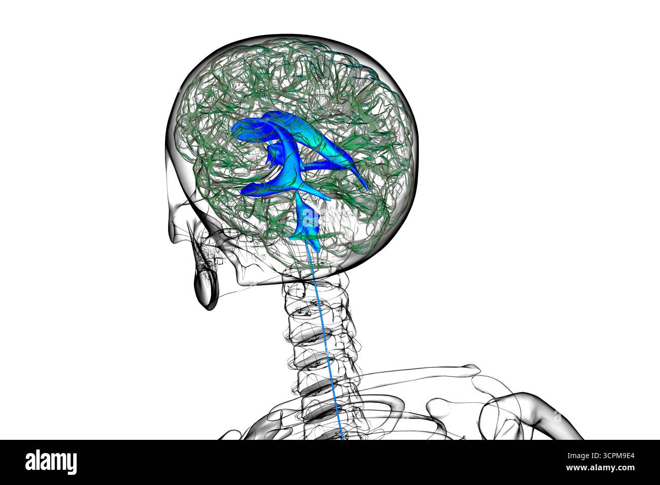 Système ventriculaire du cerveau, illustration. Les ventricules sont des cavités du cerveau qui sont remplies de liquide céphalo-rachidien (LCR). Banque D'Images