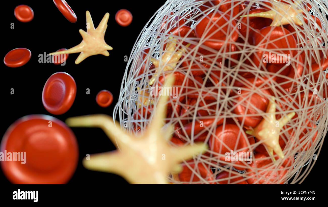 Image 3D de la formation d'un thrombus dans un vaisseau sanguin Banque D'Images