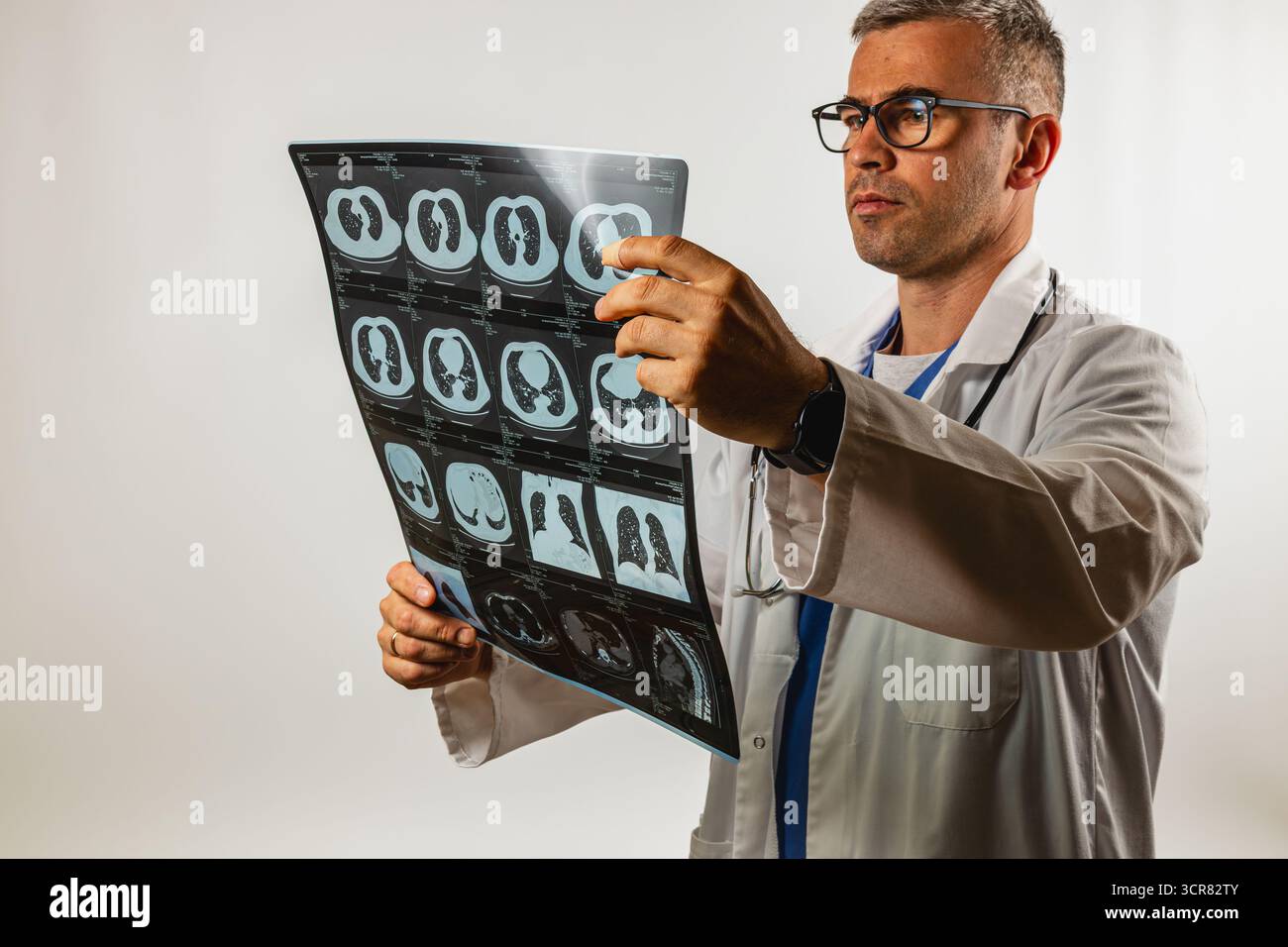 Un expert médical examine des radiographies thoraciques détaillées tout en portant une blouse de laboratoire et des lunettes, en se concentrant intensément dans un environnement clinique à la lumière du jour Banque D'Images