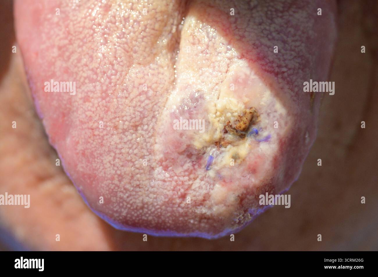 Macro gros plan d'une langue âgée avec lésion et décoloration visibles. Banque D'Images