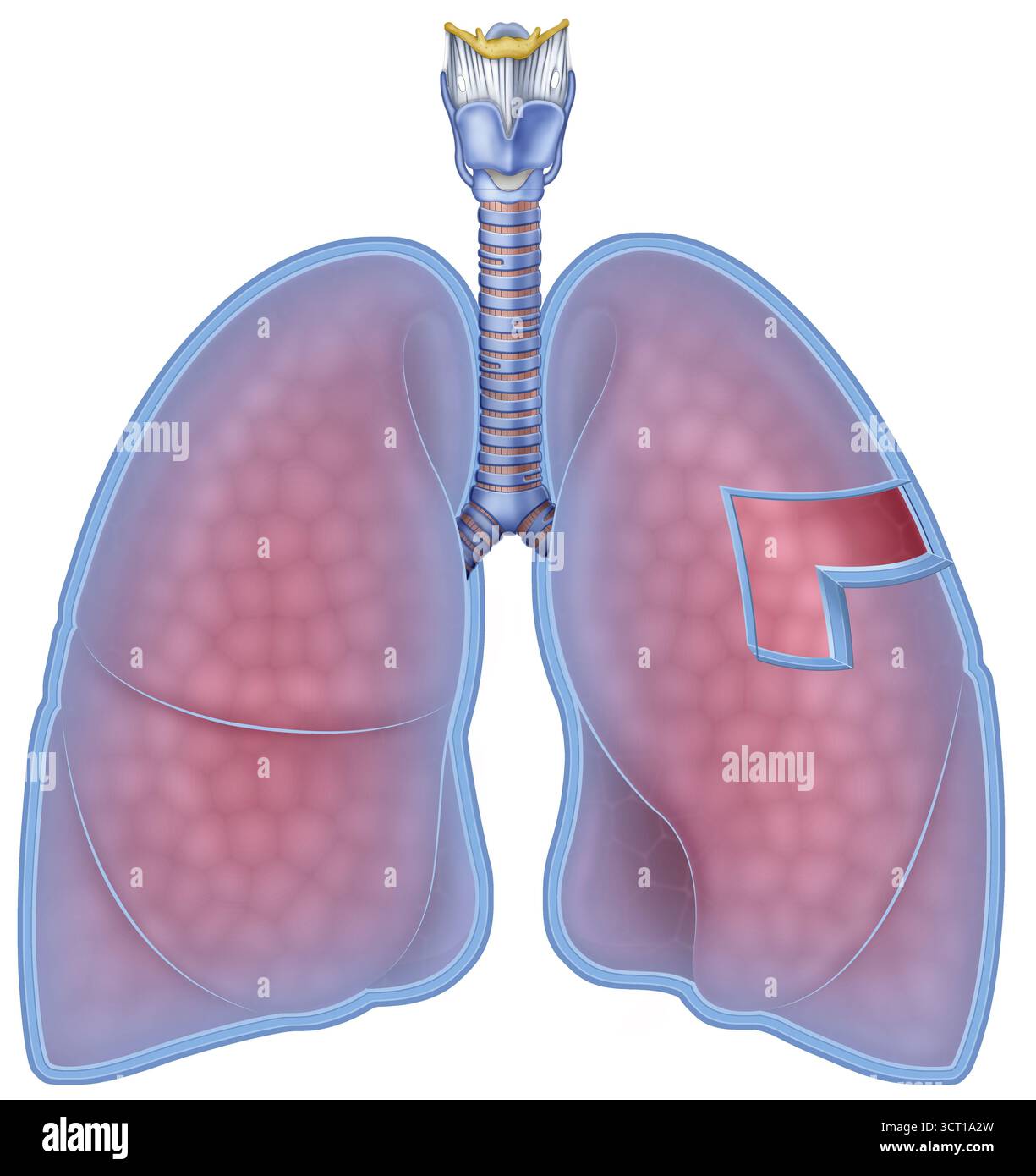 Illustration de la plèvre pulmonaire, la membrane entourant les poumons. La couche viscérale recouvrant la surface pulmonaire et la couche pariétale recouvrant la cavité thoracique sont éclairées. La plèvre pulmonaire facilite la mobilité pulmonaire pendant la respiration. Banque D'Images