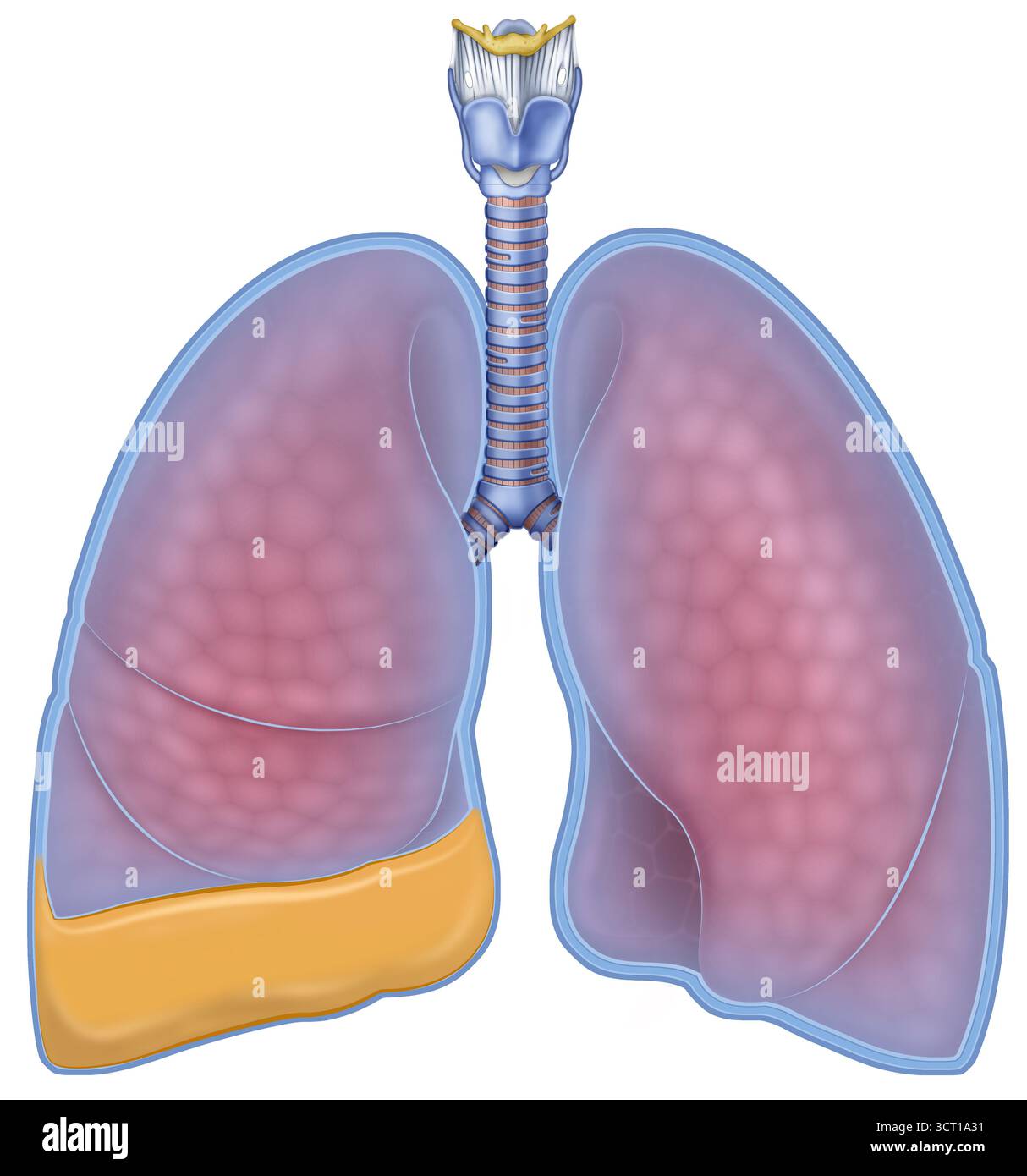 Illustration des poumons, dont l'un est atteint d'épanchement pleural (à gauche). Il s'agit de l'accumulation de liquide dans l'espace entre les poumons et la paroi thoracique (l'espace pleural). Elle peut être causée par des maladies telles que des infections, des tumeurs, un traumatisme, une insuffisance cardiaque ou une maladie du foie. Les symptômes comprennent un essoufflement et des douleurs thoraciques, mais certains épanchements peuvent être asymptomatiques. Banque D'Images