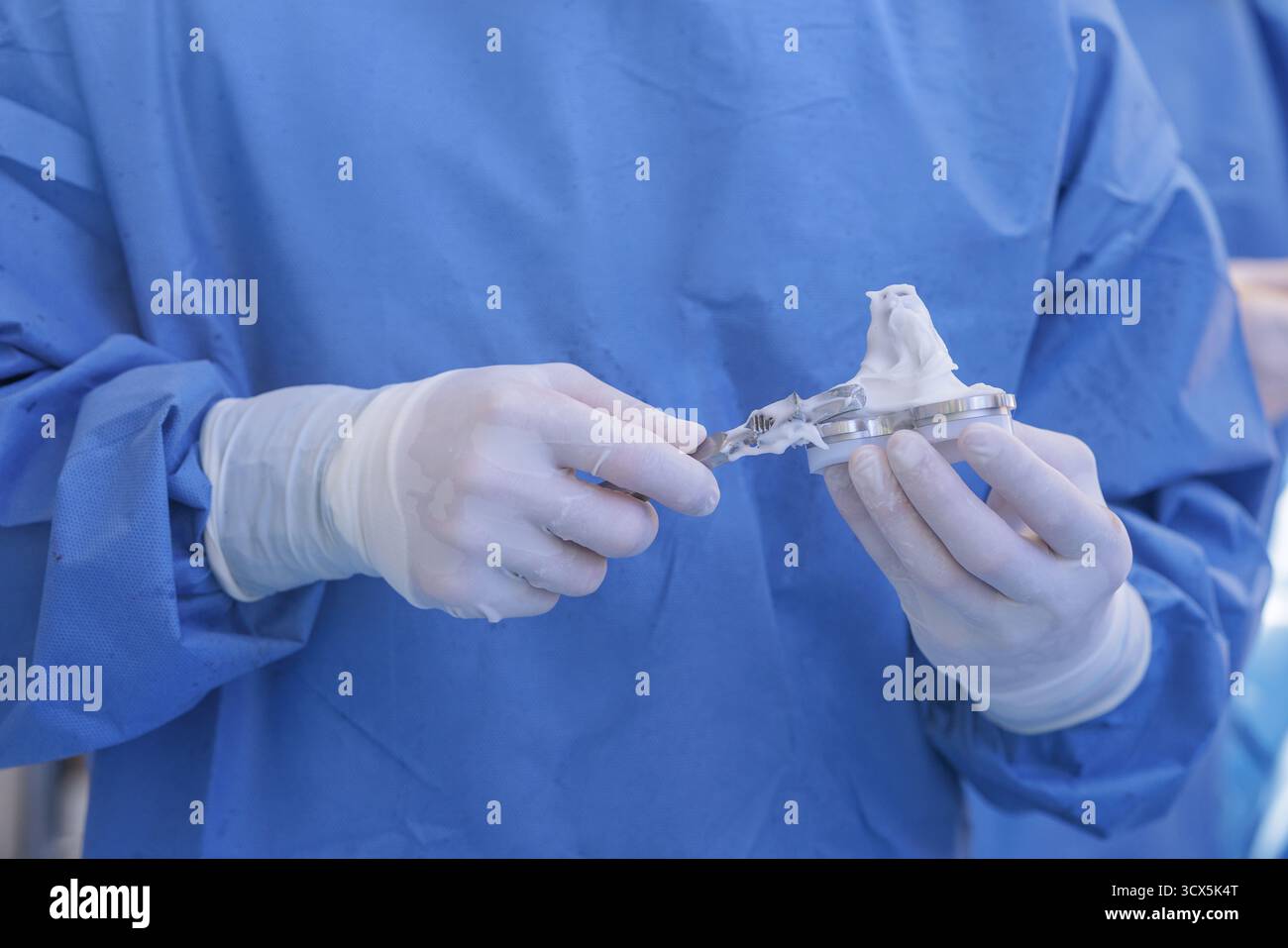 Vue rapprochée d'un chirurgien ganté étalant du PMMA sur implant tibial au cours d'une arthroplastie moderne du genou en SALLE D'OPÉRATION stérile. Banque D'Images
