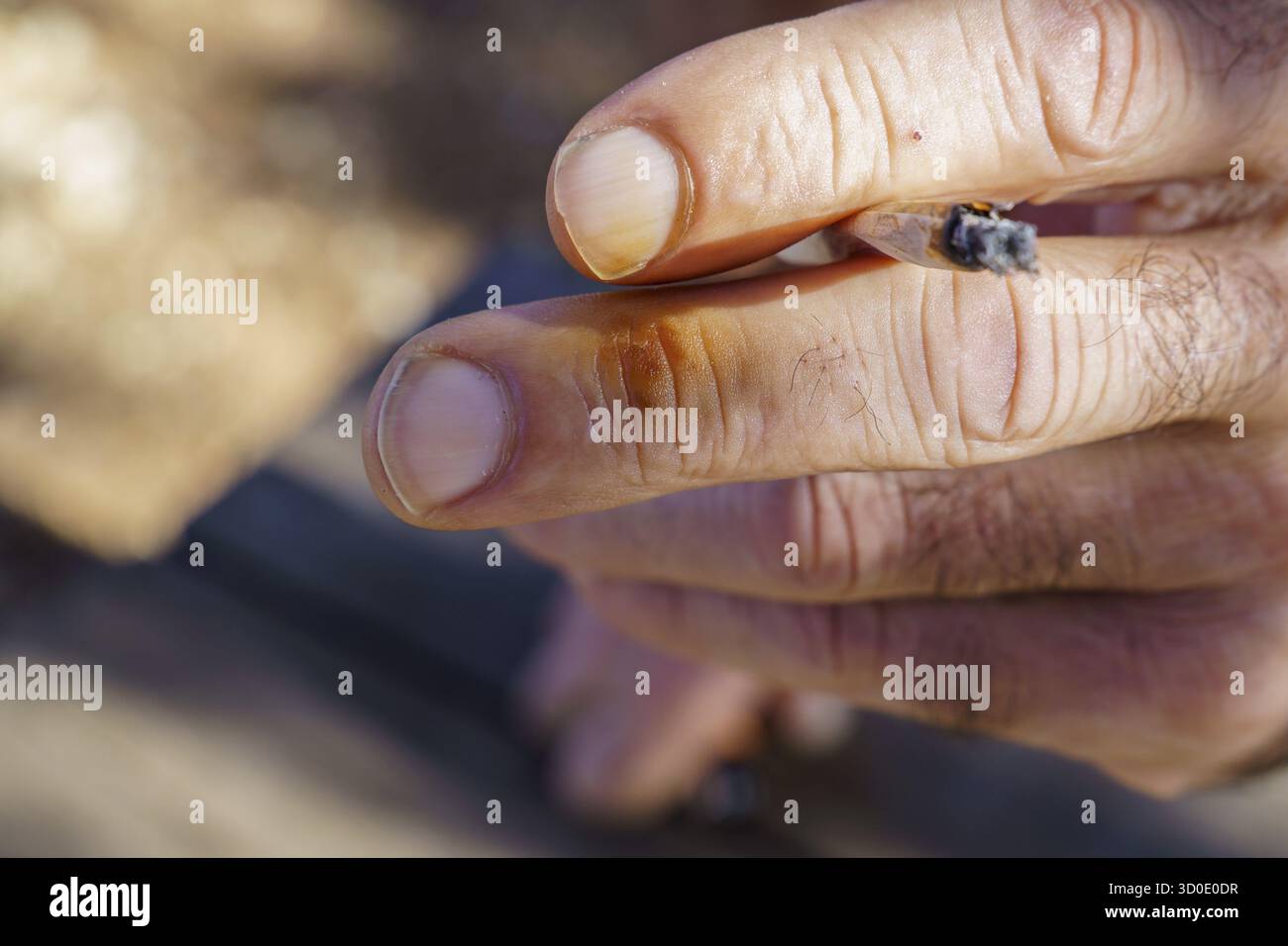 Tache de nicotine Banque de photographies et d'images  haute rsolution -  Alamy