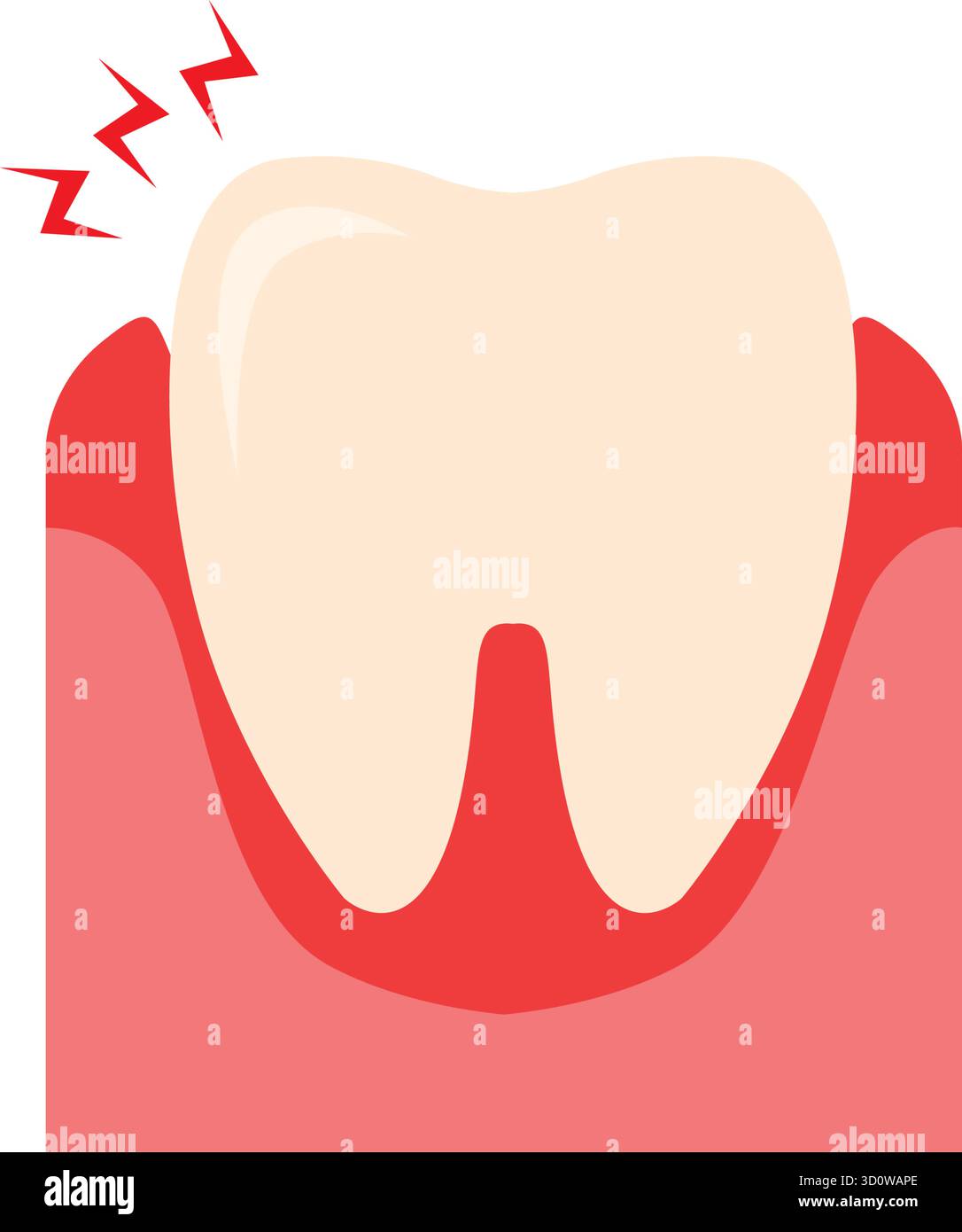 Inflammation dentaire, traitement des racines dentaires, symbole sur fond blanc. Illustration vectorielle Illustration de Vecteur