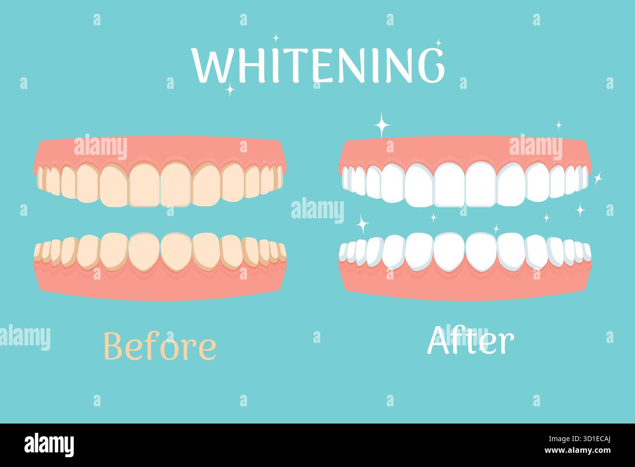 Blanchiment des dents avant et après, stomatologie, concept dentaire isolé. Stock de soins de santé et de beauté. Illustration vectorielle Illustration de Vecteur