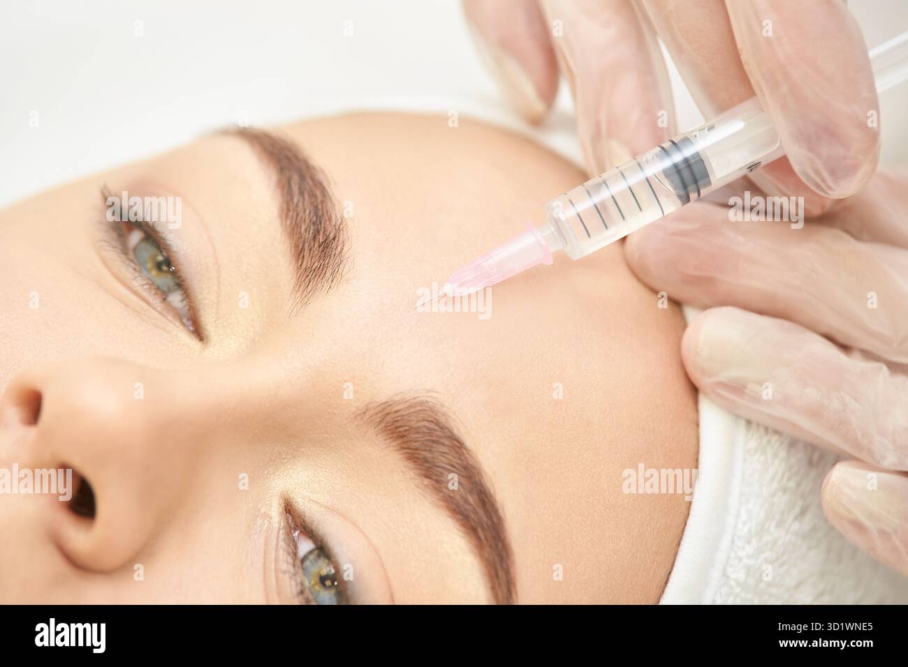 Chirurgie de femme de front. Mastic anti-rides. Injection de cosmétologie. Face Banque D'Images