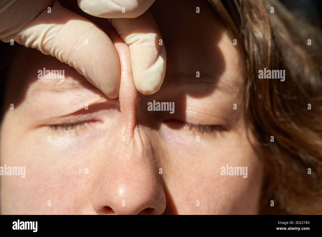 Gros plan du test d'élasticité cutanée sur le nez ganté d'une jeune femme caucasienne Banque D'Images