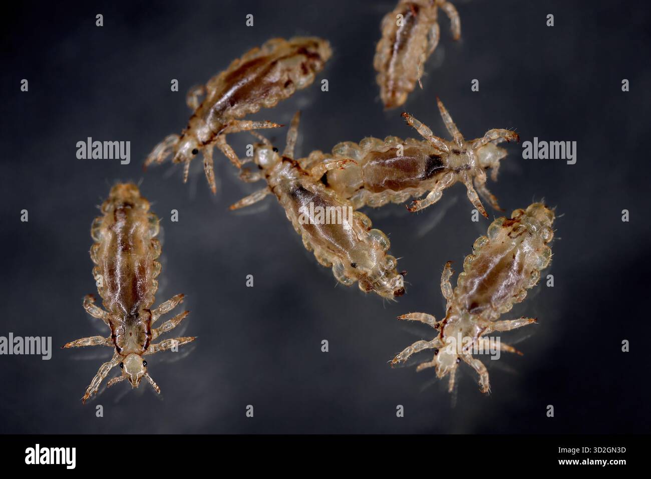 Poux de tête. Ectoparasite de sucer le sang humain. Les poux de tête. Banque D'Images