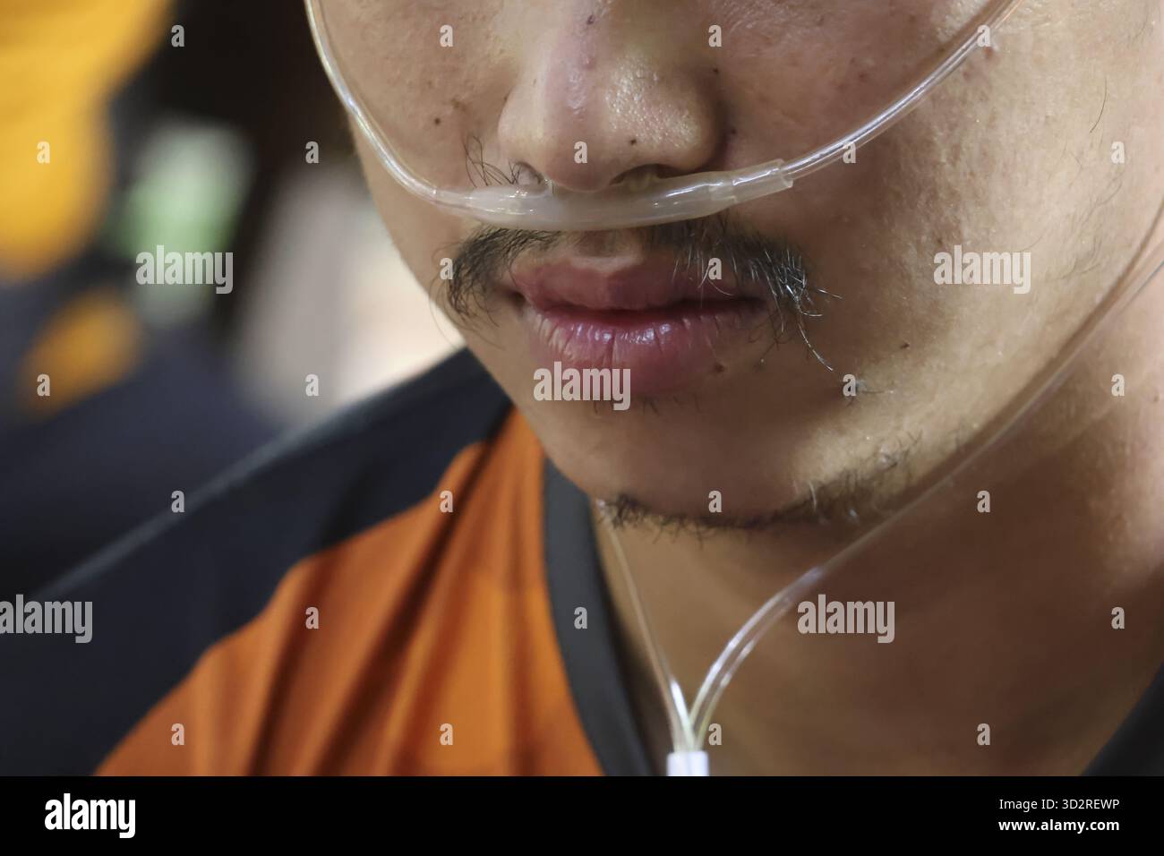 Gros plan de la bouche et du nez d'un jeune homme asiatique avec une canule nasale, montrant sa détermination et sa lutte pour respirer, indiquant le besoin d'oxygénothérapie A. Banque D'Images