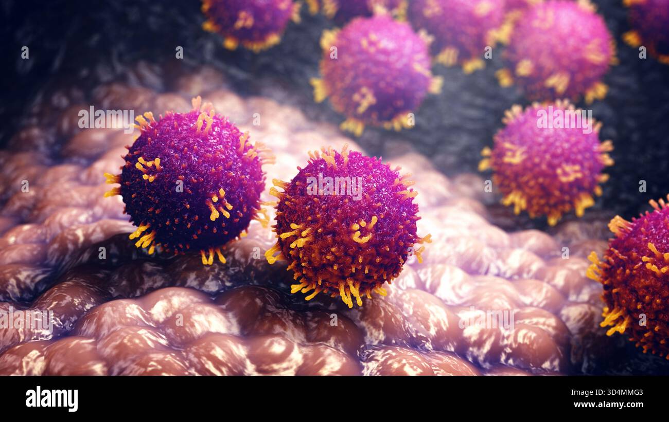 La rougeole, également connue sous le nom de morbille et de rubéole, est une infection virale infantile très contagieuse. Le virus infecte les voies respiratoires puis se propage Banque D'Images