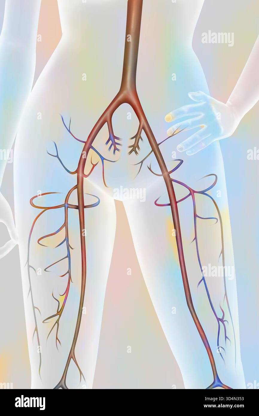 Artères du bassin et de la cuisse. L'aorte abdominale bifurque, au niveau du bassin, en deux artères iliaques communes, droite et gauche. Banque D'Images