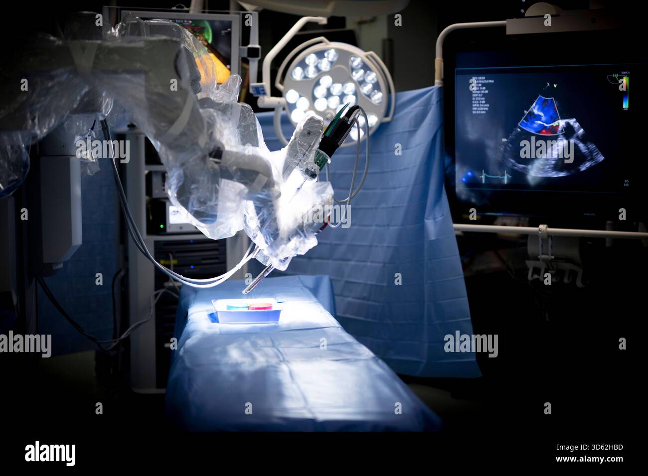 Roboter in der Herzchirurgie DEU, Deutschland, Allemagne, Berlin, 12.11.2025 Detail Operationstisch und Monitor einer Herzoperation am DHZC , BEI einer Vorfuerung einer robotergestuetzte Operation an Herzklappen vom Da-Vinci-Robotiksystem im Deutschen Herzzentrum im Rudolf-Virchow-Krankenhaus der Berliner Charite in Berlin tschland . Die robotergestuetzte chirurgie ist ein modernes Operators Verfahren in der Medizin. SIE ermoeglicht dem Operateur, minimalinvasive Operationstechniken mit Unterstuetzung des roboterassistierten Systems noch exakter und sicherer durchzufuehren als konventionelle Banque D'Images