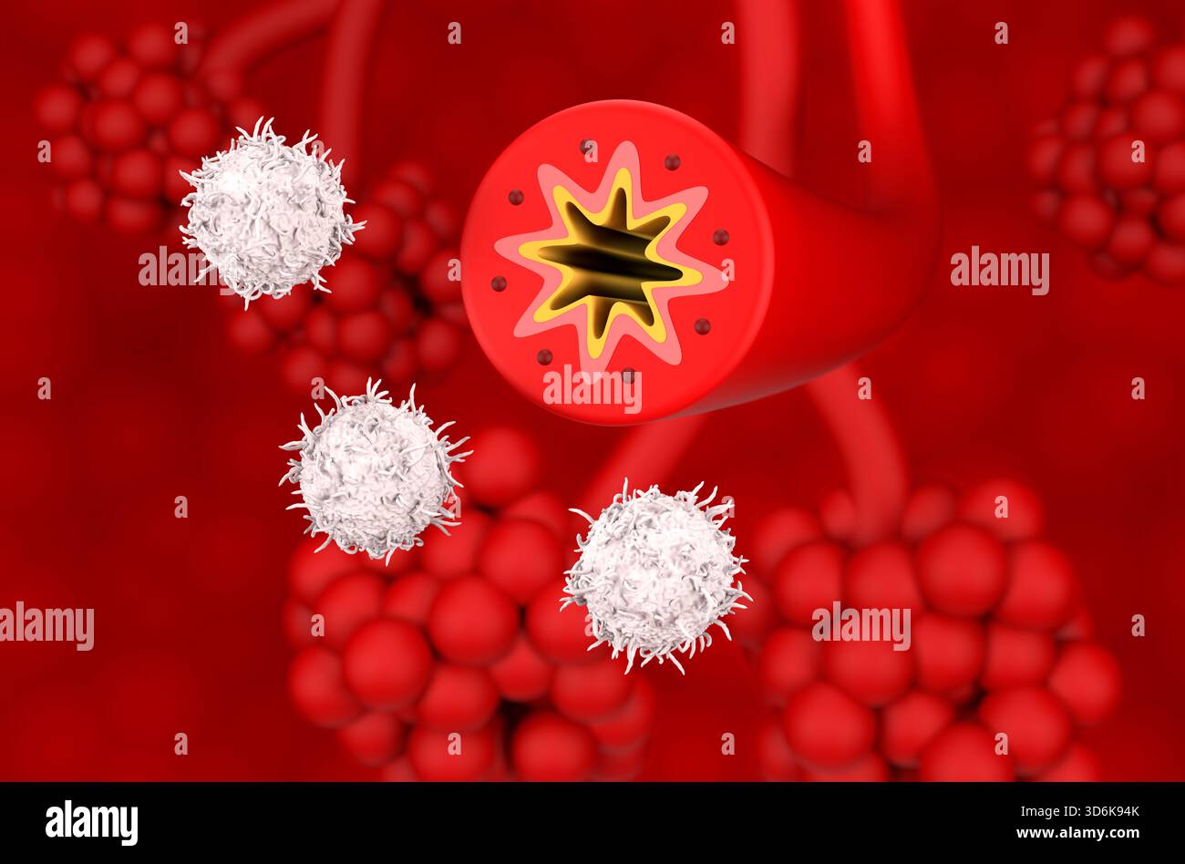 Thérapie médicamenteuse à cellules T dans l'asthme - vue isométrique illustration 3D. Banque D'Images