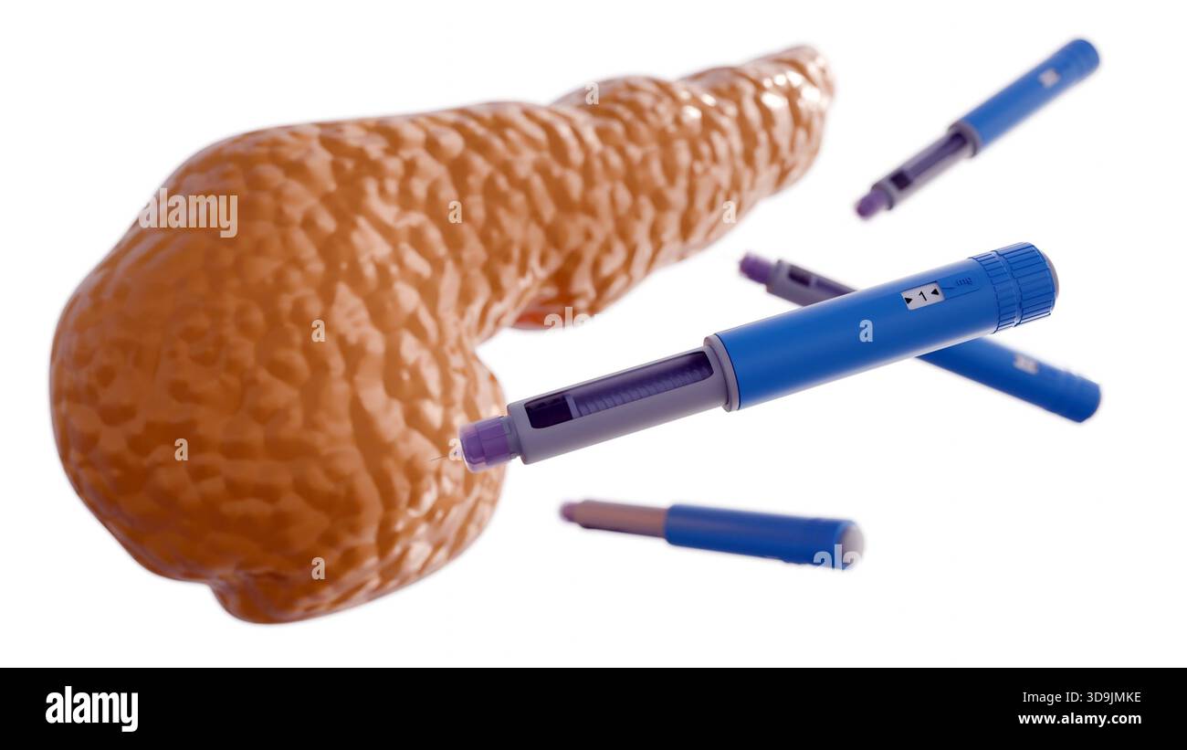 Un rendu 3D du pancréas humain et plusieurs stylos auto-injecteurs bleus et violets, couramment utilisés pour l’administration d’insuline par les personnes atteintes de diabète. Banque D'Images