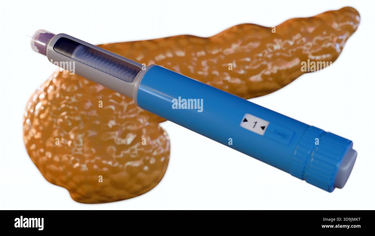 Un rendu 3D du pancréas humain et plusieurs stylos auto-injecteurs bleus et violets, couramment utilisés pour l’administration d’insuline par les personnes atteintes de diabète. Banque D'Images