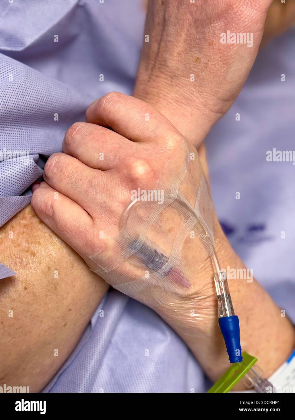 Gros plan d’un implant IV fixé à la main d’un patient, à la tubulure et au cathéter en place, reflétant une anticipation silencieuse avant la chirurgie dans un ensemble médical calme Banque D'Images