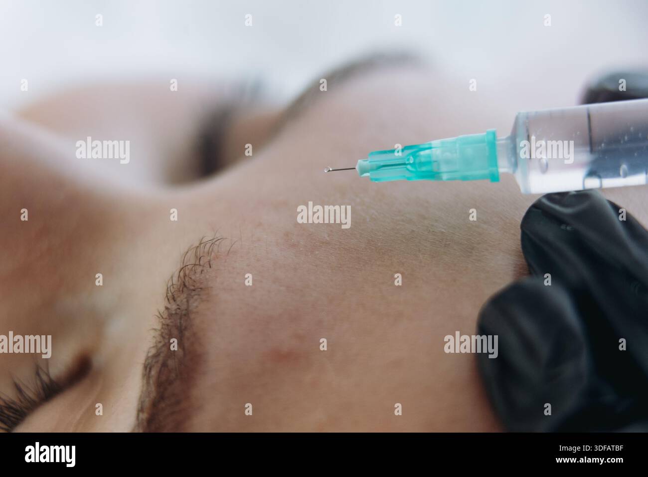gros plan des mains professionnelles faisant une injection de rajeunissement dans la ligne sournoise de la femme Banque D'Images