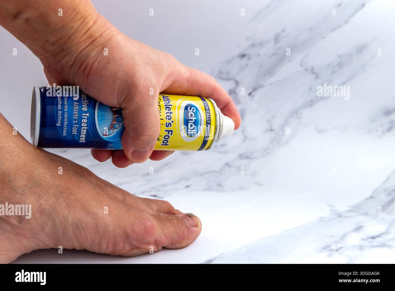 Londres. Royaume-Uni- janvier 14.2026. Gros plan d'une personne utilisant un récipient de Scholl Athlete's Foot Spray Liquid sur un pied, isolé sur un dos en marbre blanc Banque D'Images