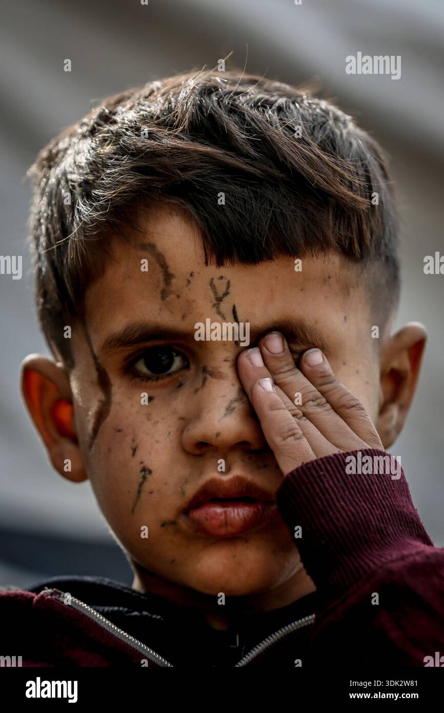 ADEM Suleiman Abu Halib, un garçon palestinien de 5 ans qui a perdu 13 parents dans une frappe israélienne contre sa maison du camp de Nuseirat, est vu dans la bande de Gaza le 19 janvier 2026. Aveuglé par des éclats d'obus au visage, il vit maintenant dans une tente dans le camp avec son oncle, luttant pour survivre. (Photo Saeed Jaras/Middle East images/StringersHub/SIPA USA) Banque D'Images