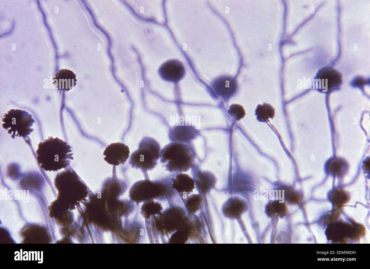 La photomicrographie à un grossissement de 100x montre la morphologie ultrastructurale du champignon Aspergillus Niger, y compris les hyphes septés, filamenteux, hyalins et les vésicules colorées foncées (têtes rayonnées) portant de nombreuses conidies, 1965. Image reproduite avec l'aimable autorisation du CDC. Banque D'Images