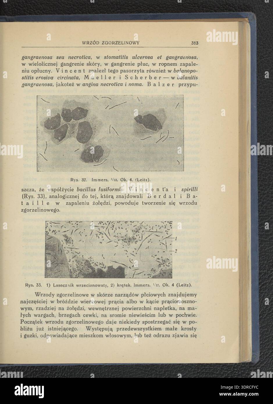 Le livre de 1932 'maladies vénériennes' de Feliks Malinowski, publié à Varsovie par Warszawska Agencja Wydawnicza 'Delta', contient 504 pages avec 18 tableaux, mesurant 23 cm. Il offre des informations médicales factuelles sur les infections sexuellement transmissibles, couvrant les causes, les symptômes, les méthodes de diagnostic et les traitements. Le livre traite de la prévention, de l'examen clinique et des protocoles thérapeutiques. Destiné aux professionnels de la santé et aux étudiants, il est une référence en vénéréologie, santé publique et pratique clinique au début du XXe siècle en Pologne. Banque D'Images