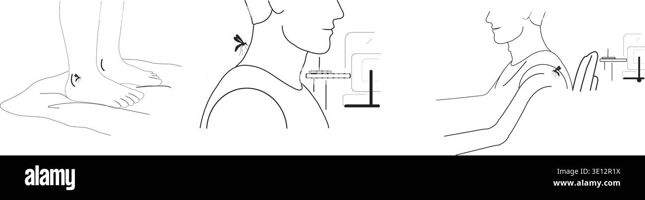 Moustique piquant la cheville humaine et se nourrissant de sang de la peau mettant en évidence le danger de piqûre d'insecte Illustration de Vecteur