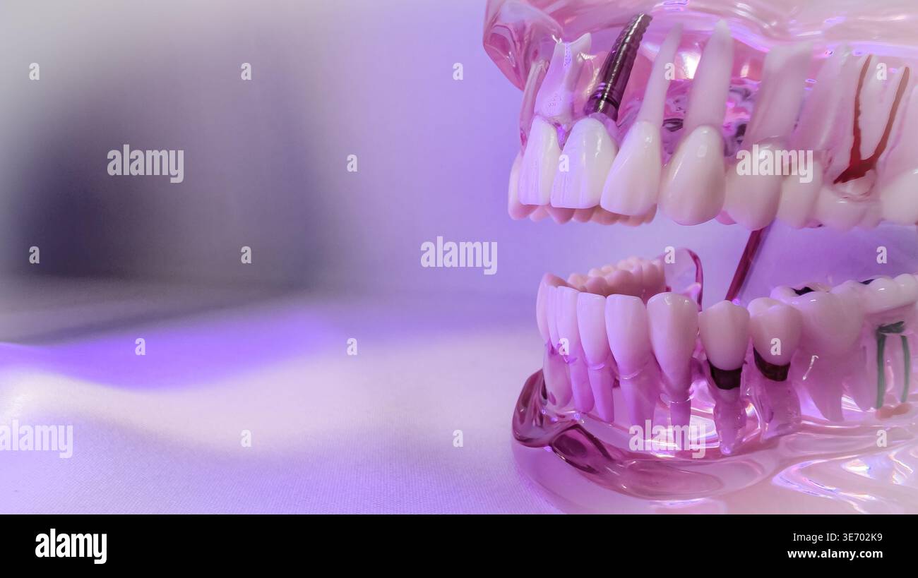 Modèle de mâchoire dentaire translucide sous la lumière rose et violette avec espace de copie Banque D'Images