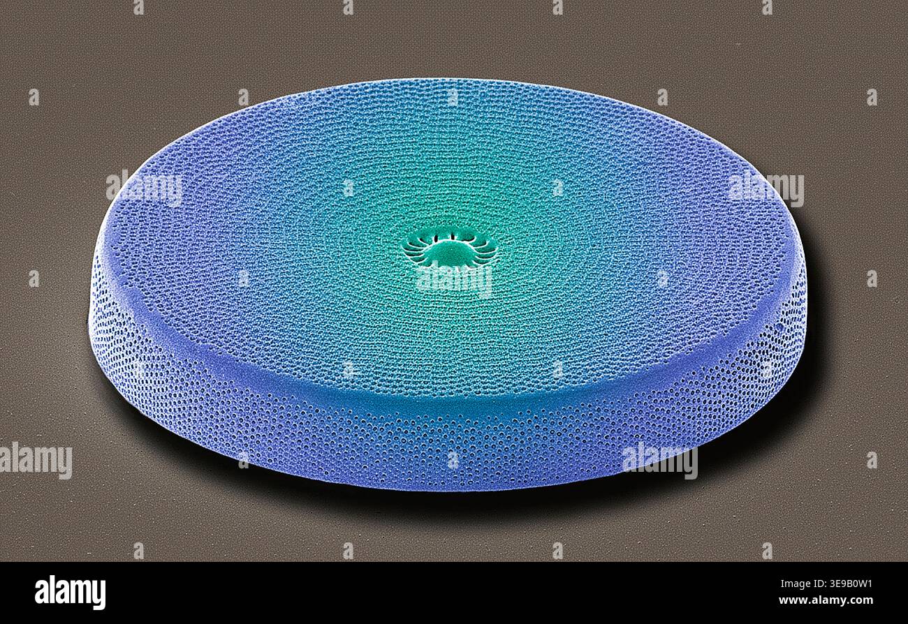 Diatomée. Diatomée de micrographie électronique à balayage couleur (MEB). Grossissement : x2000 lors de l'impression à 10 centimètres de large. Banque D'Images