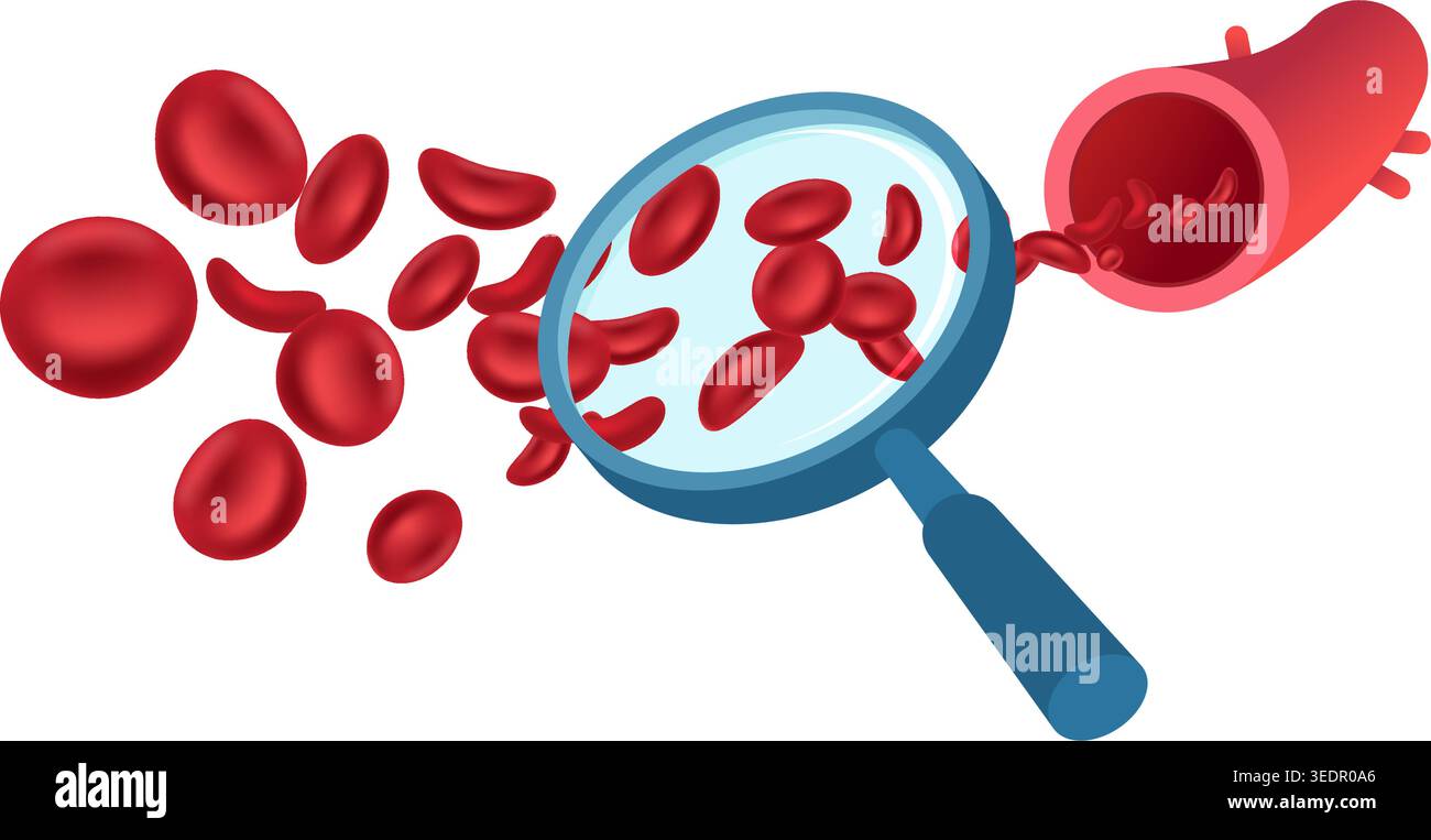 Concept médical détaillé des globules rouges se déplaçant à travers une artère vu avec une loupe sur fond blanc. Illustration de stock. Illustration de Vecteur