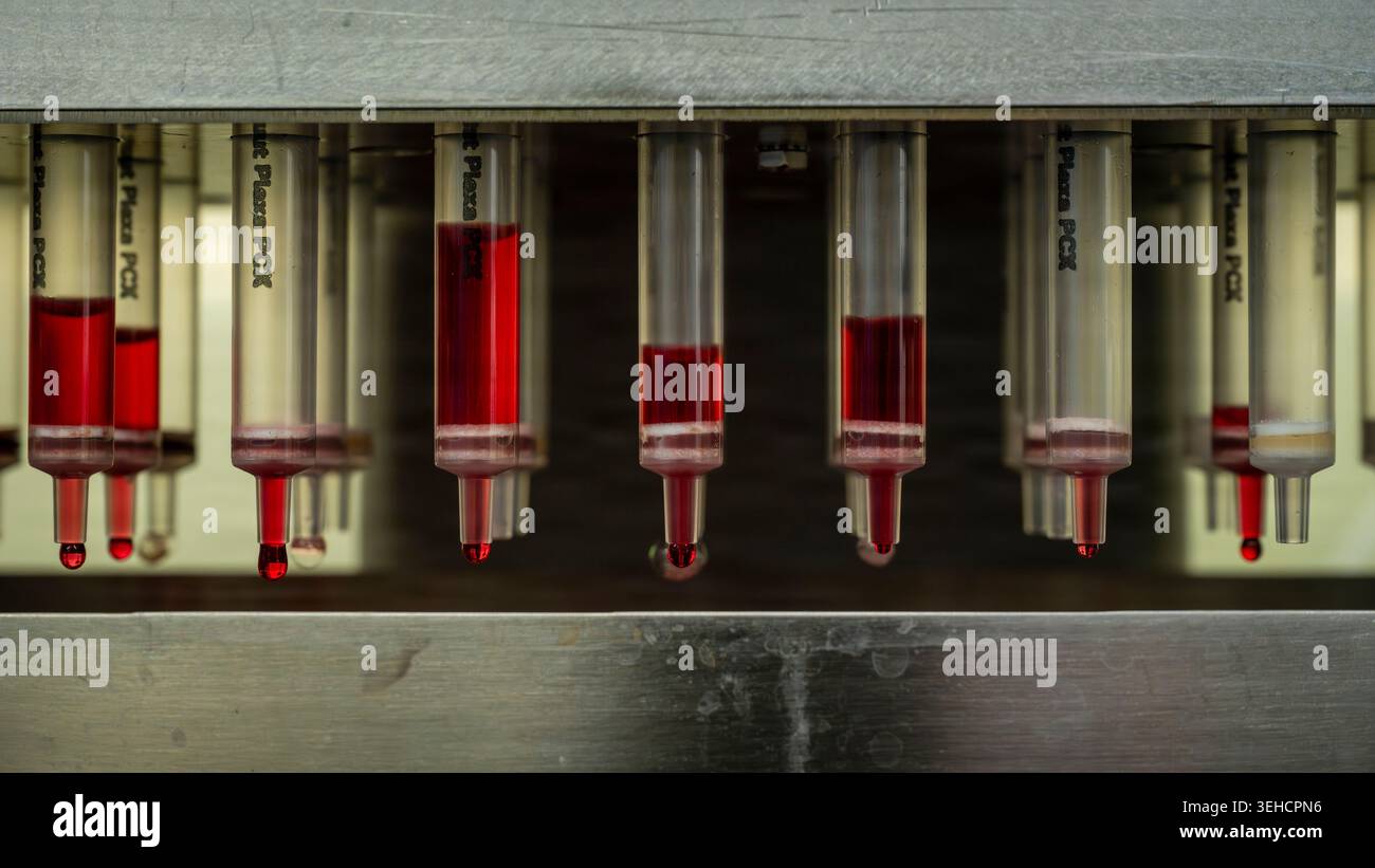 Les composants indésirables de l'échantillon s'égouttent d'une colonne d'extraction en phase solide sur un collecteur à pression positive, dans le laboratoire d'extraction du FORTOX DIV Banque D'Images