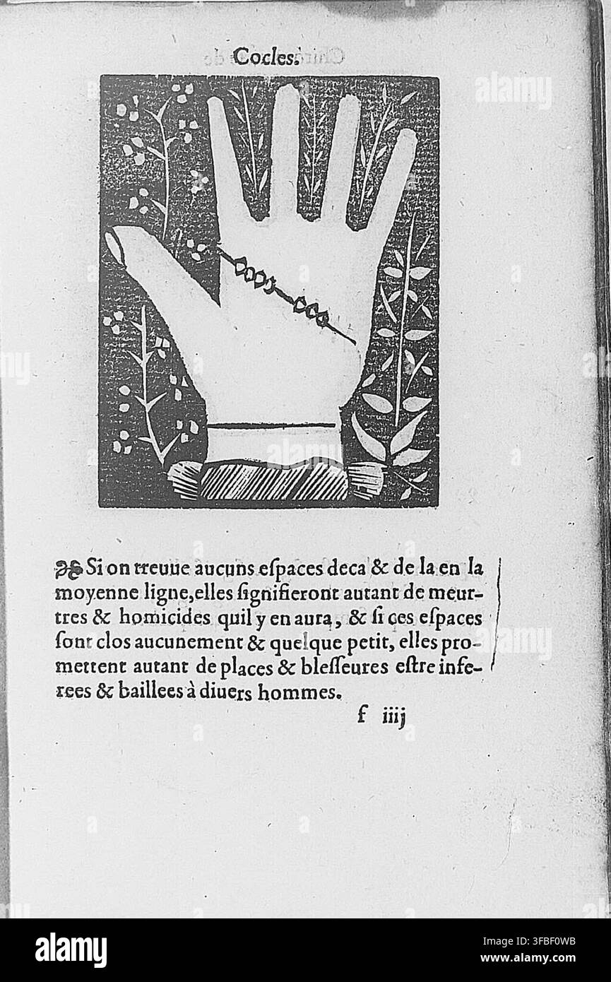 Une page de texte imprimé de 1560 sur l'anatomie humaine, présentant une illustration d'une main avec un serpent, accompagnée d'un passage discutant l'interprétation des caractéristiques physiques et leur relation aux actes violents ou aux blessures. Banque D'Images