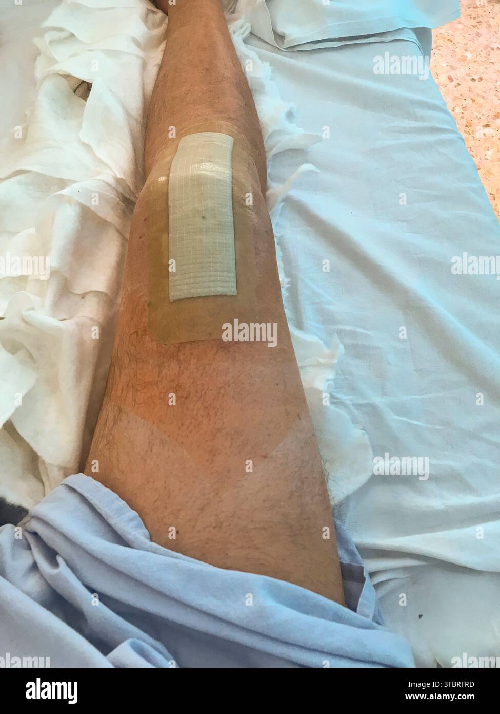 La jambe d'un homme est enveloppée de bandages. Les bandages sont blancs et bruns. La jambe est enveloppée de manière à ce qu'elle ne soit pas visible Banque D'Images