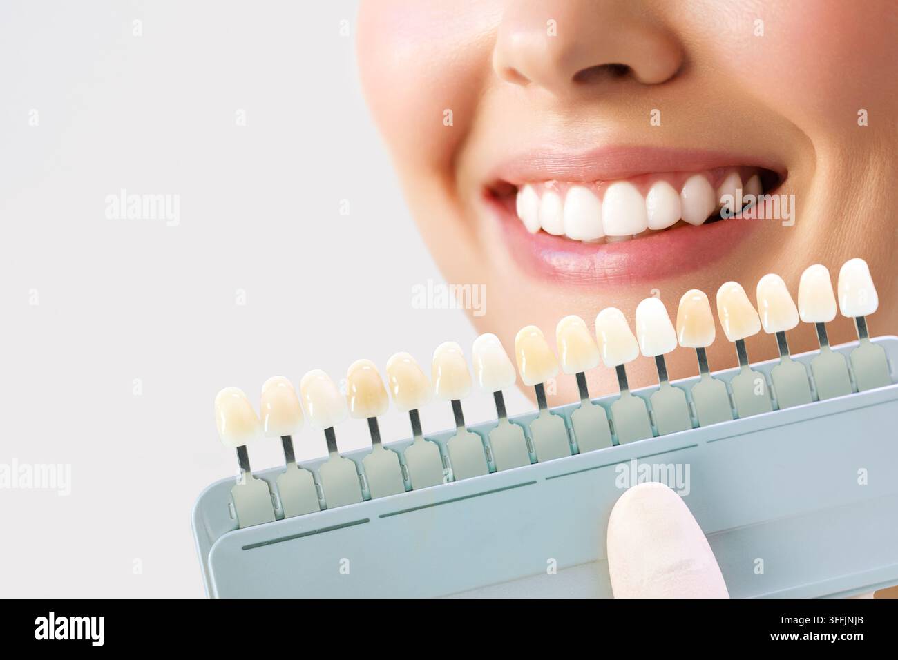 Sourire féminin avec guide de teinte dentaire pour l'appariement des couleurs des dents Banque D'Images