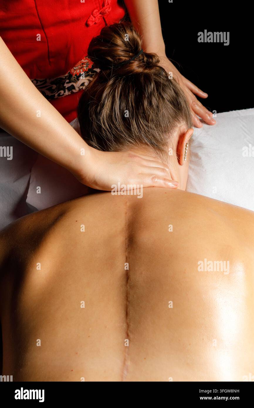 Femme avec une cicatrice chirurgicale recevant une thérapie par massage du dos Banque D'Images